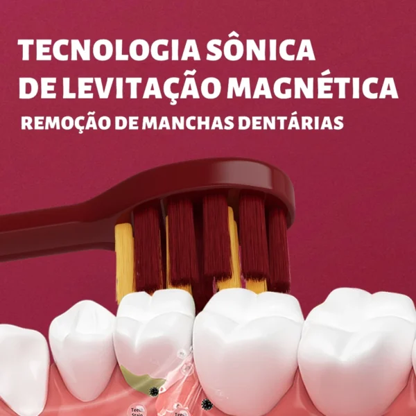 OralGos® Escova Dental Sônica com Levitação Magnética – 38.000 Vibrações por Minuto e Tecnologia Premium DB888-M6 - Imagem 8