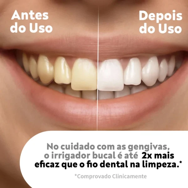 OralGos® Irrigador Bucal Portátil – Limpeza Profissional DB901 - Imagem 7